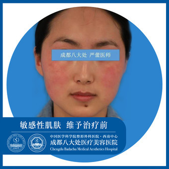 八大处医疗美容医院严蕾医生怎么样_价格_案例